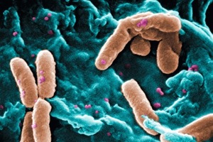  Pseudomonas aeruginosaBei einer Wasseranalyse darf in 100 ml kein einziger dieser Erreger vorkommen 