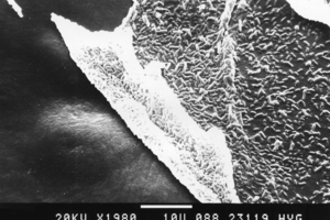  Mikrobielle BelägeZwei Bilder eines jungen, dünnen Biofilms auf der inneren Oberfläche eines Silikonschlauchs. In diesen Biofilmen sind stäbchenförmige Bakterien sehr gut erkennbar. Es handelt sich hier zwar nicht um Legionellen, aber die Art der Besiedlung ist typisch für mikrobielle Beläge 
