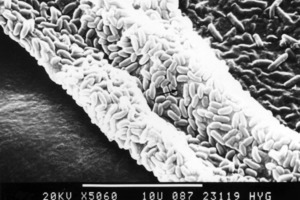  Typischer mikrobieller BelagBild eines jungen, dünnen Biofilms auf der inneren Oberfläche eines Silikonschlauchs in der Vergrößerung: In diesen Biofilmen sind stäbchenförmige Bakterien sehr gut erkennbar; zwar handelt es sich hier nicht um Legionellen, aber die Art der Besiedlung ist typisch für mikrobielle Beläge 